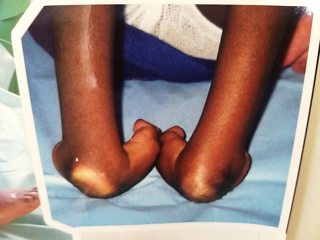 Feuerkinder Ärztin Waldsassen Tansania