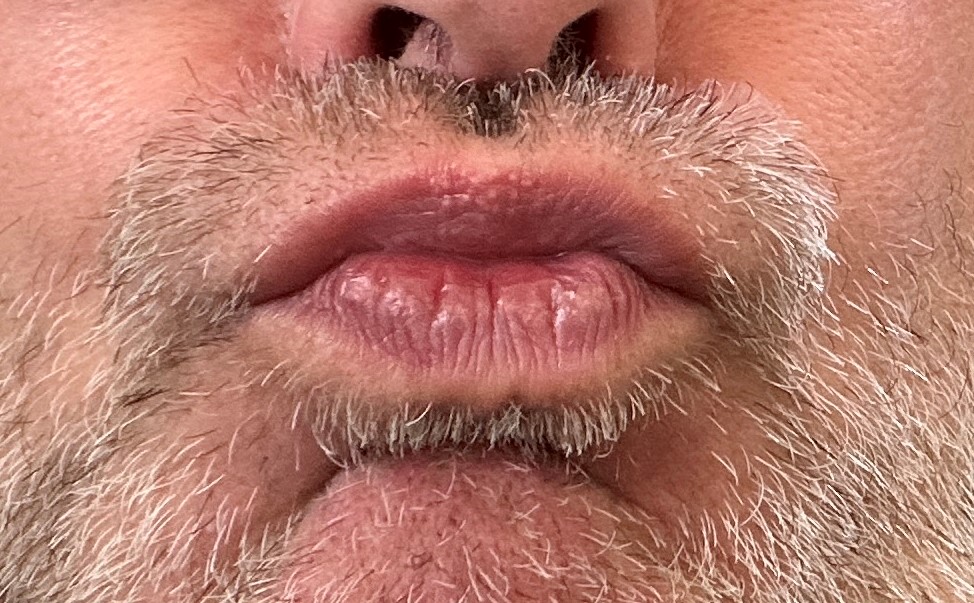 Unser Oberpfälzer Dialekt (1): Das ultimative Rüstzeug für den Faschingsendspurt