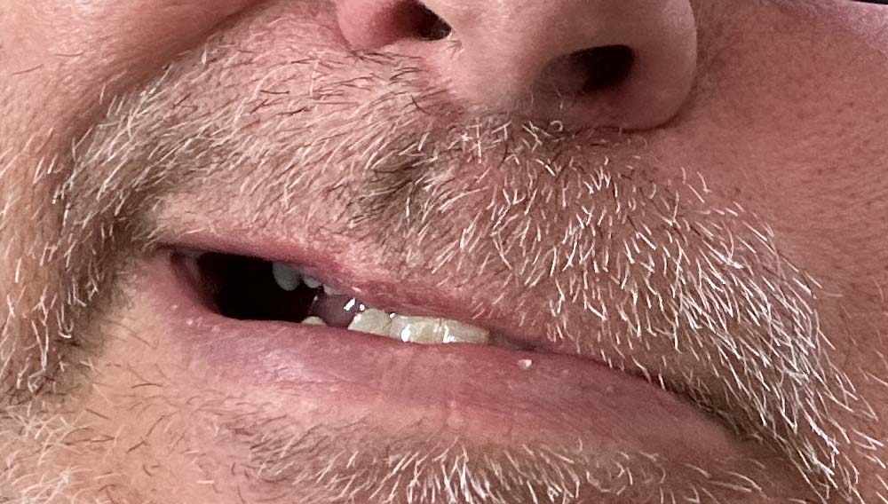 Unser Oberpfälzer Dialekt (3): Waal mia koi Gloiffl san