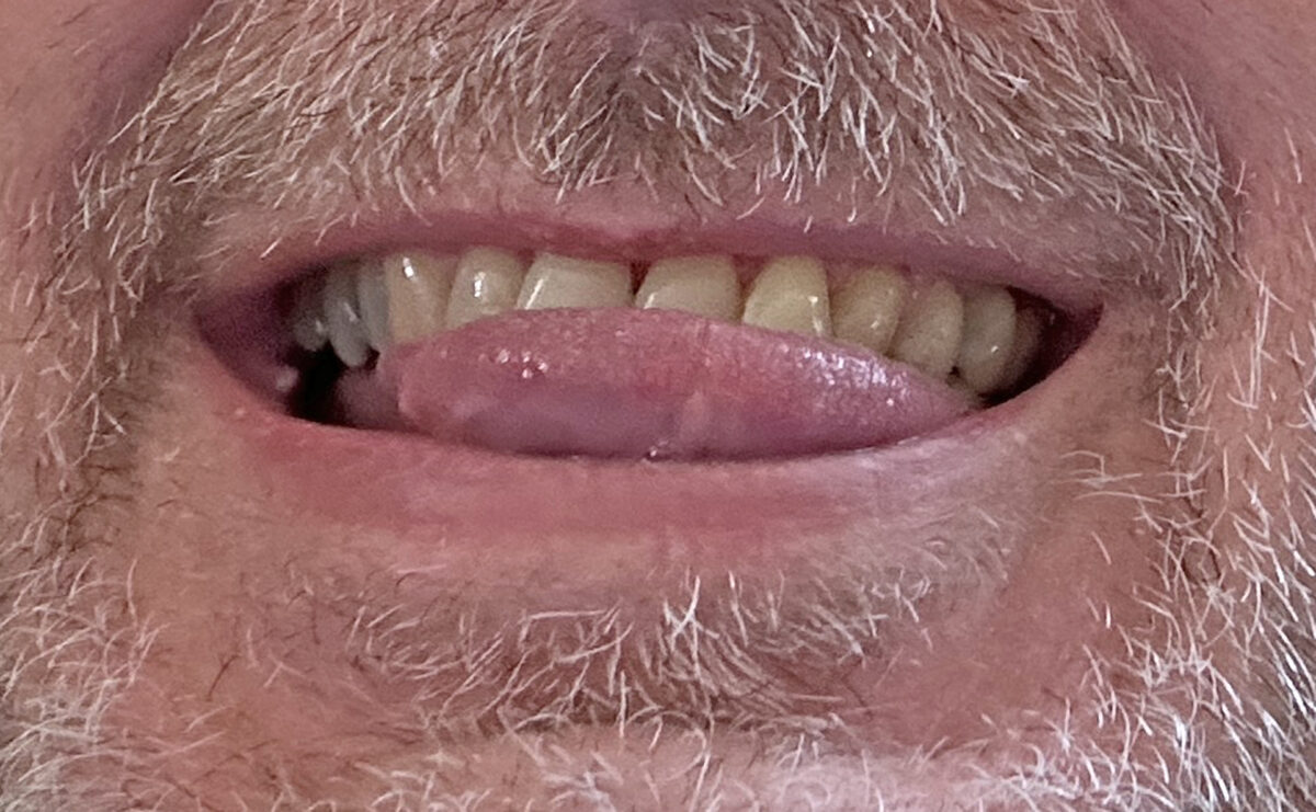 20240719 Blaijdsinn Foto M